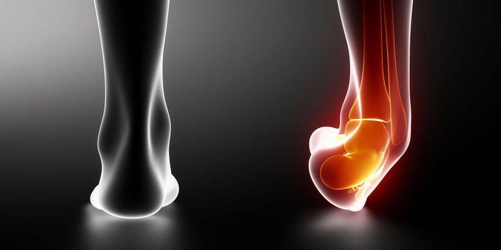 What Is Ankle Instability? And What Are the Causes for The Same?