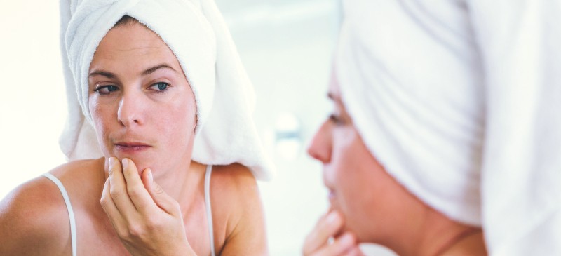 What is Hirsutism?