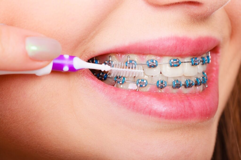 How Family Dentistry Supports Long Term Orthodontic Success