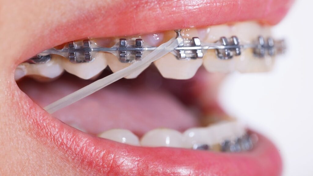 Signs Your Child May Need Orthodontic Treatment
