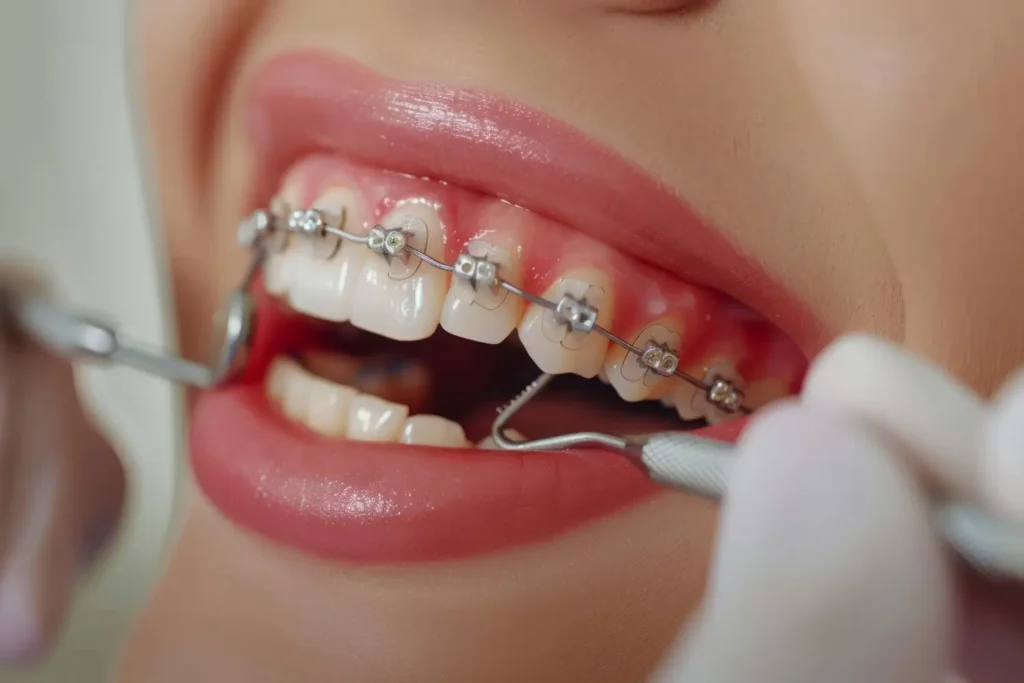 3 Signs You Could Benefit From Cosmetic And Orthodontic Care