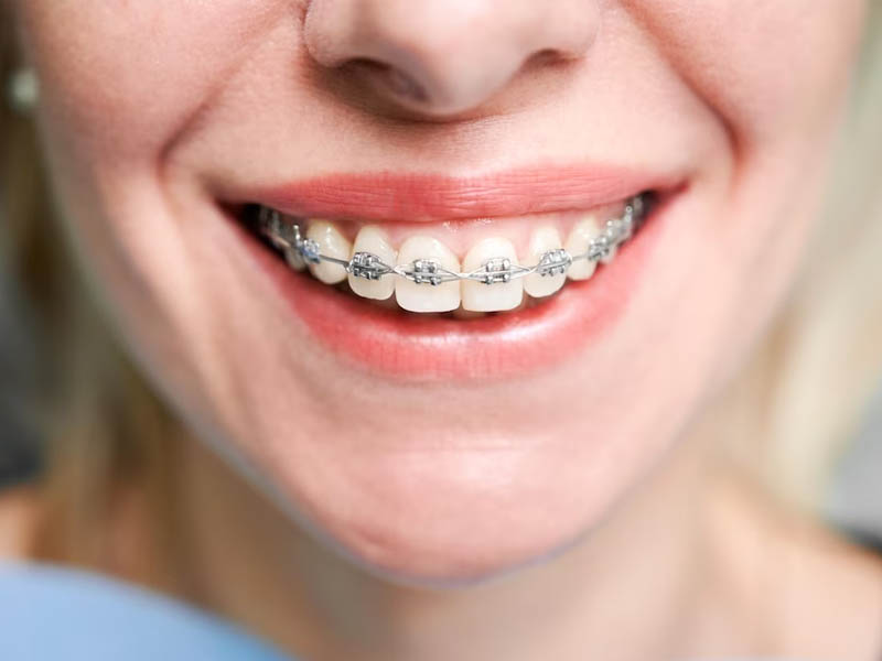 3 Cosmetic Dentistry Treatments Ideal For Busy Parents