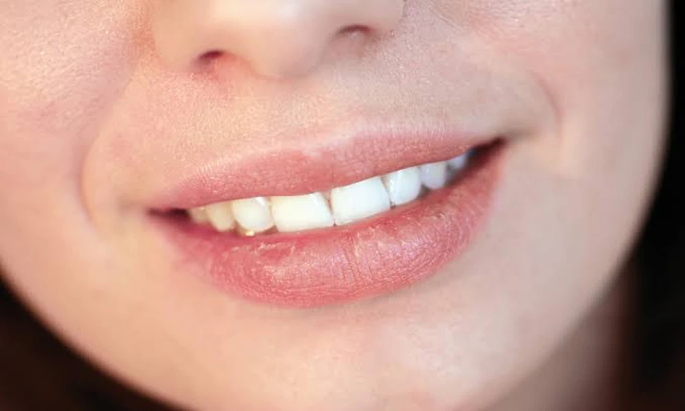 7 Conditions That Can Make Your Mouth Feel Dry